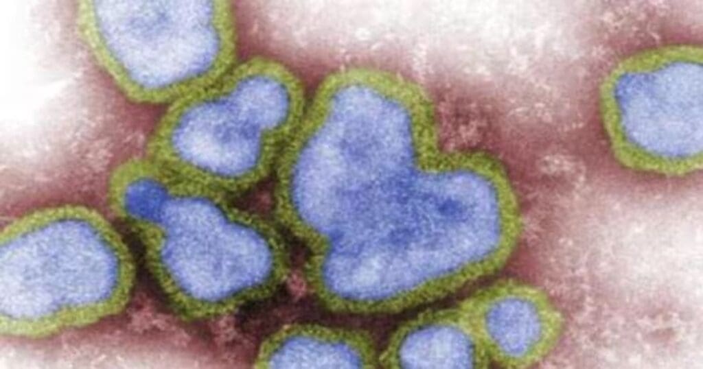 H3N8 virus