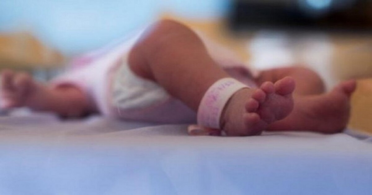 Baby Born with Two Penis