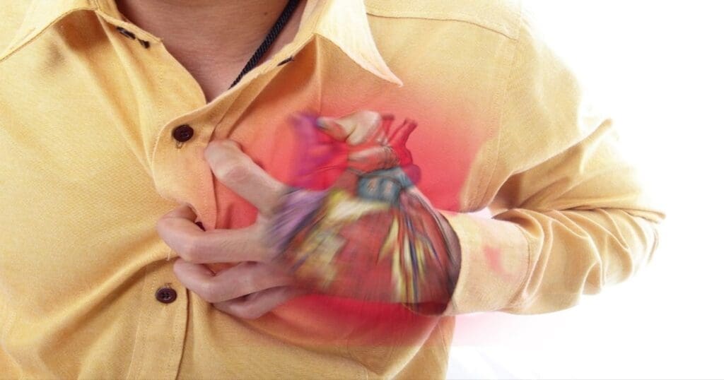 Heart attack and cardiac arrest