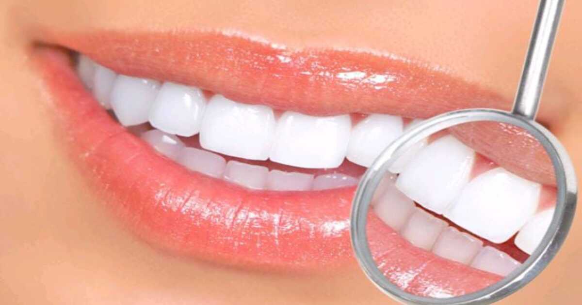 Tips for shiny teeth