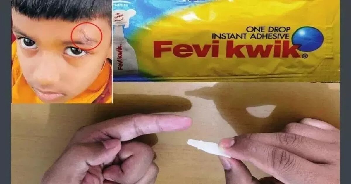 Fevikwik