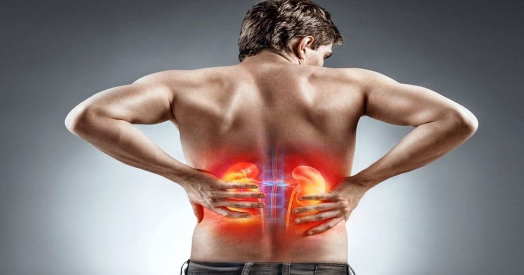 kidney failure