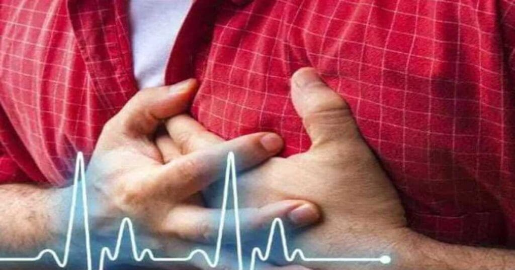 Heart attack