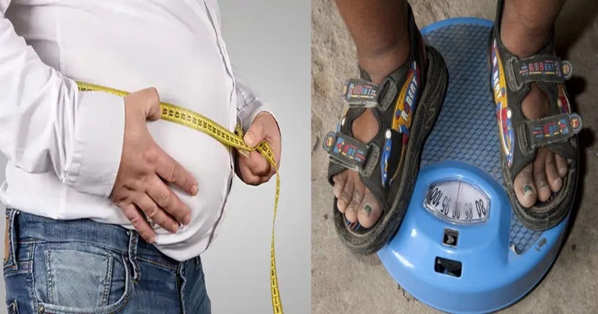 IMG-20230606-WA0047 Obesity