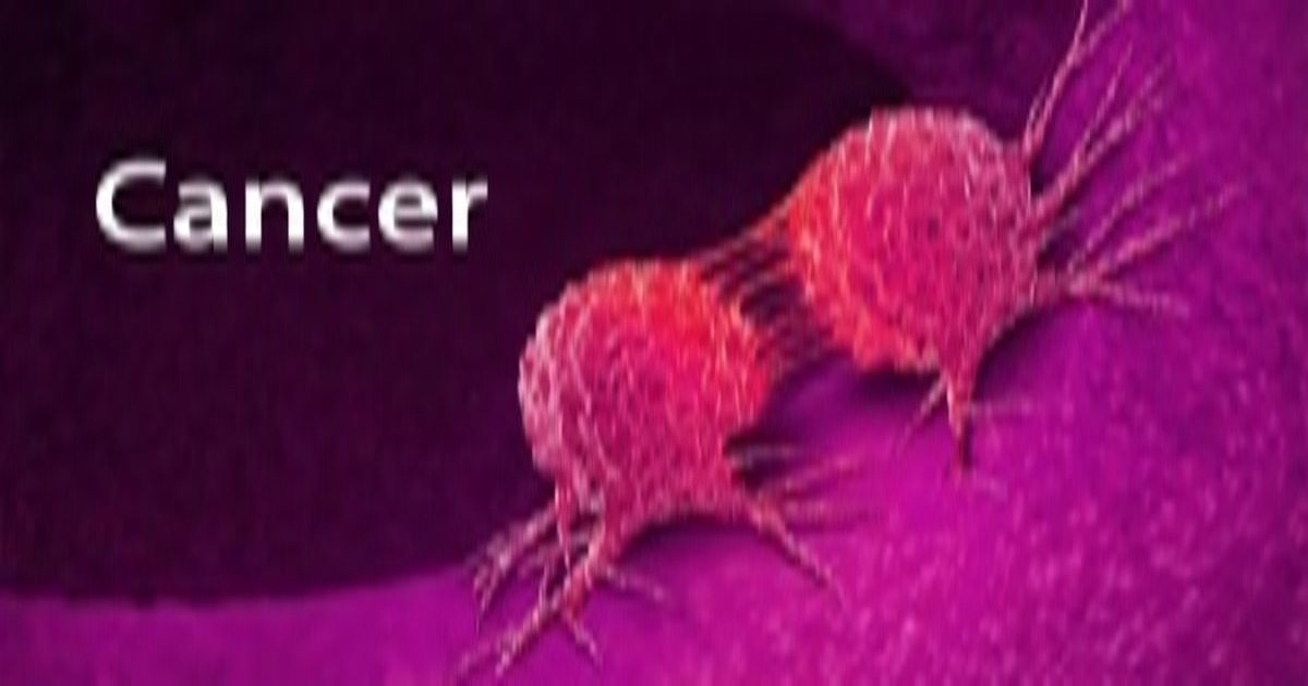 Liver cancer