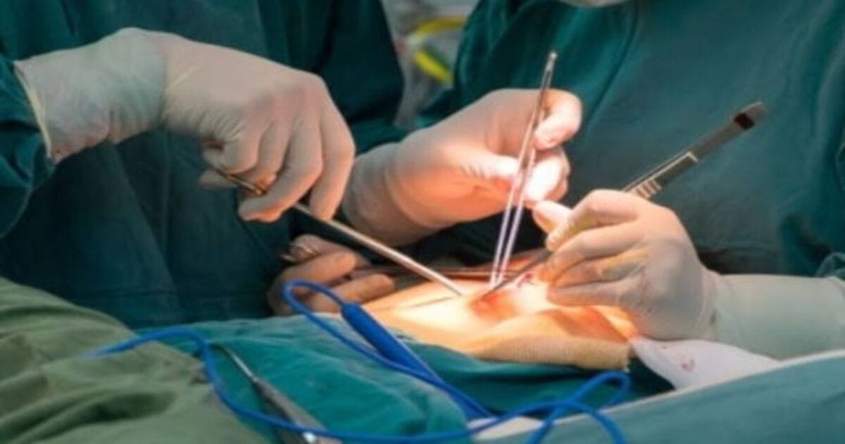 cesarean surgery