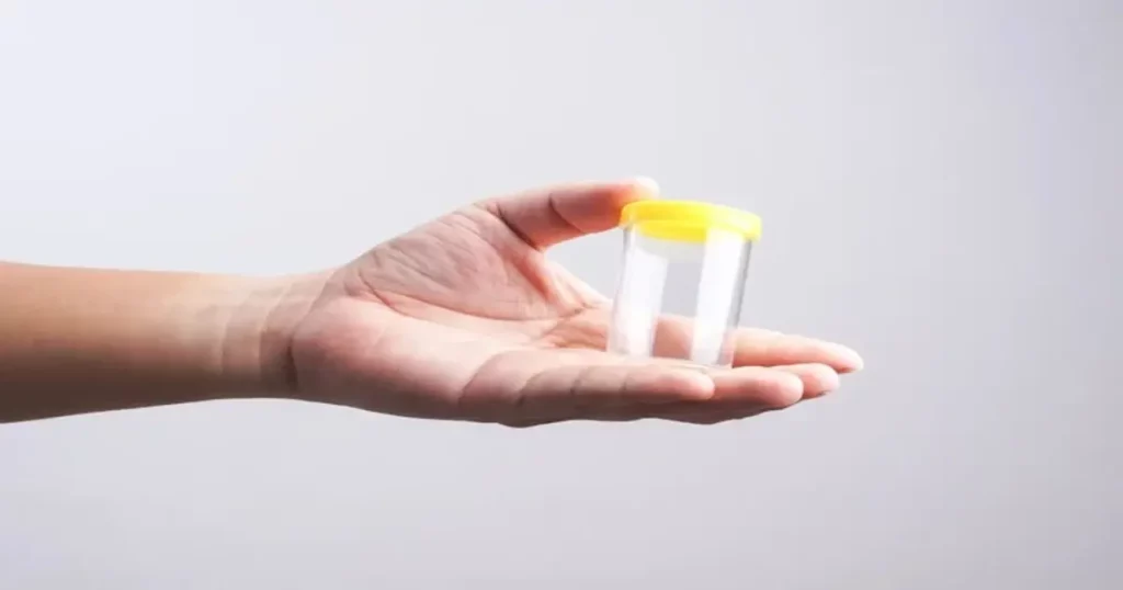 Yellow Semen