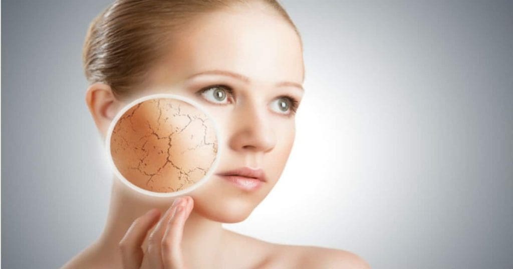 Winter Dry skin