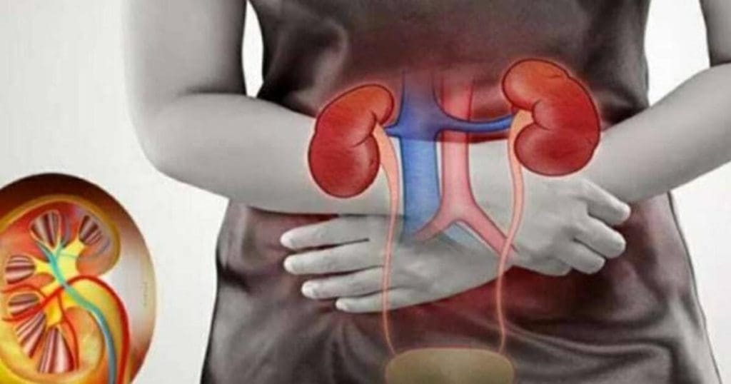 Kidney failure