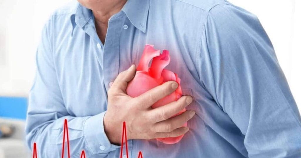 Heart Attack