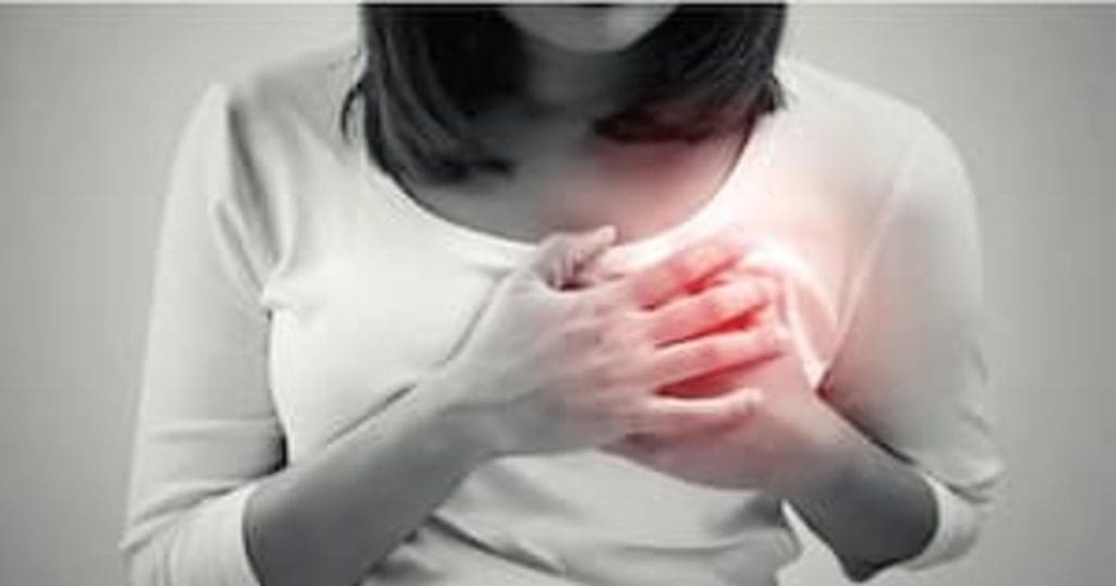 Heart attack