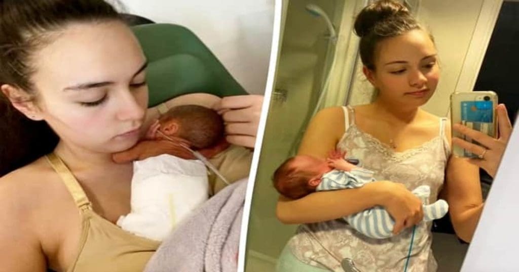 Rarest Twins Born
