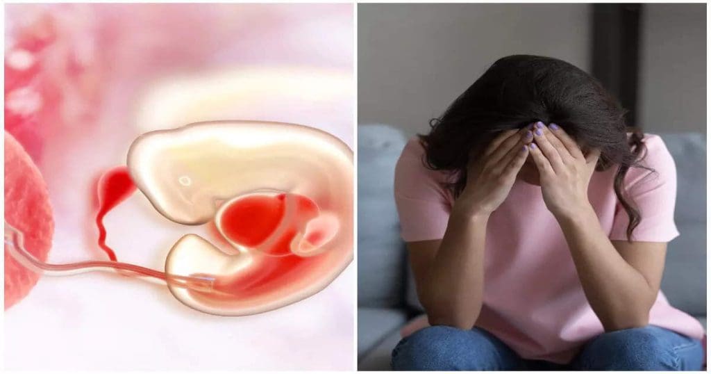 Abortion