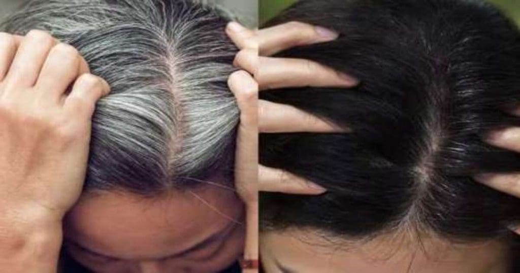 White Hair