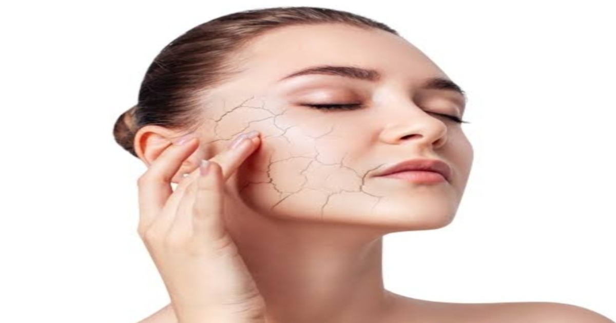 Tips for Dry Skin: