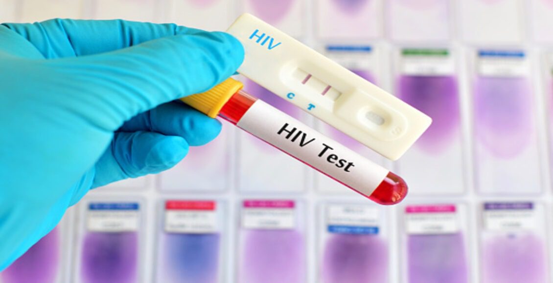 Students HIV Case