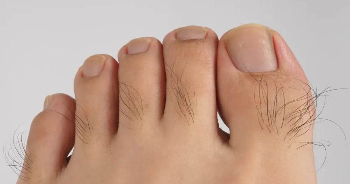 Toe hair