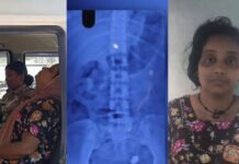 Kerala: ಮಗುವಿನ ಕುತ್ತಿಗೆಯಲ್ಲಿದ್ದ ಚೈನ್ ಕದ್ದು ನುಂಗಿದ ಕಳ್ಳಿ – ತೆಗೆಯಲು ಪೋಲೀಸರ ಹರಸಾಹಸ